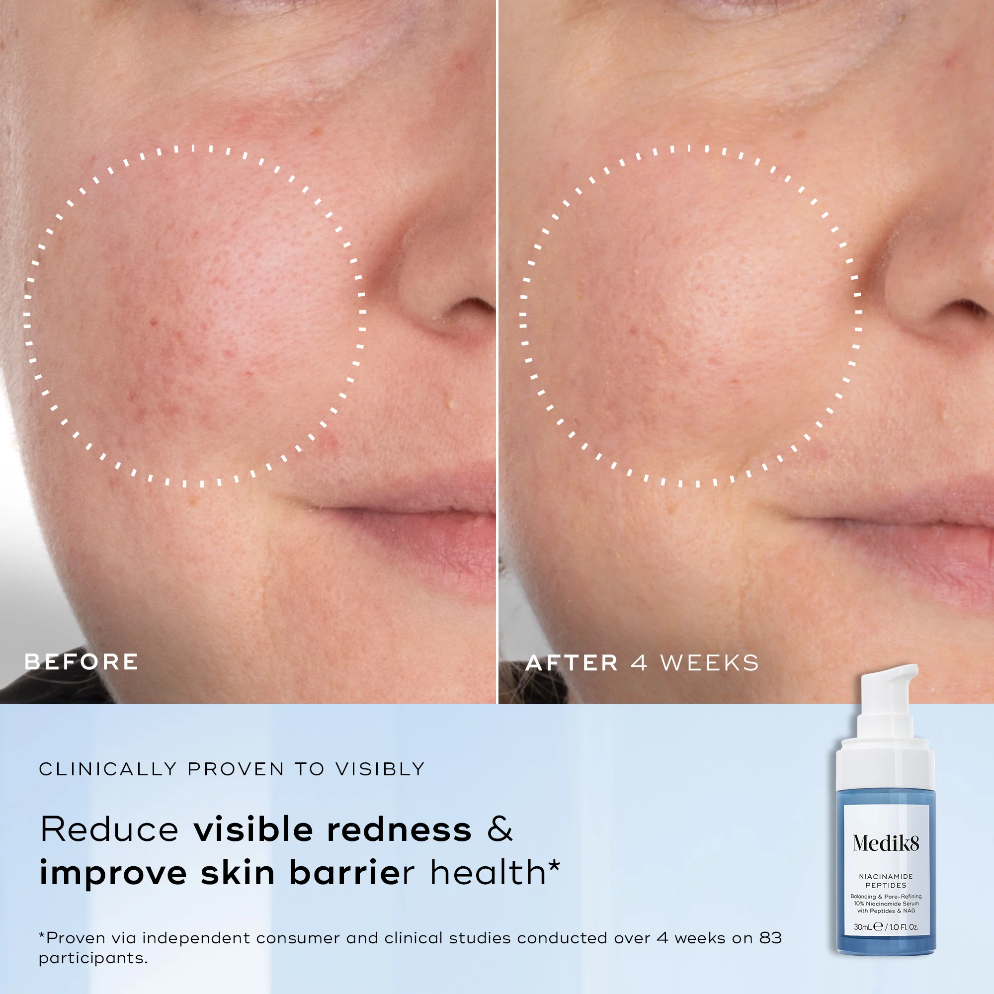 Niacinamide Peptides 30ml - Image 4