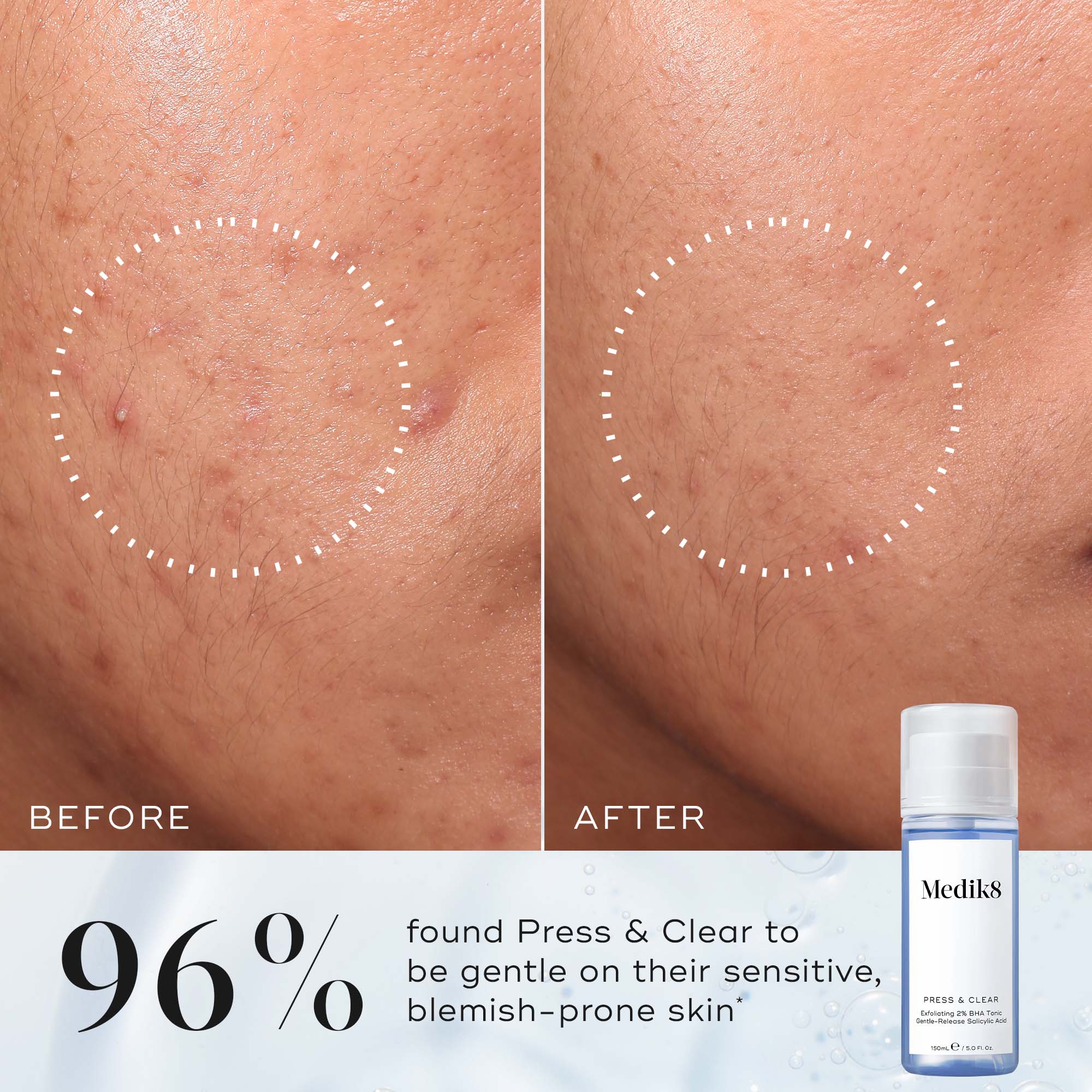 Press & Clear 150ml - Image 4