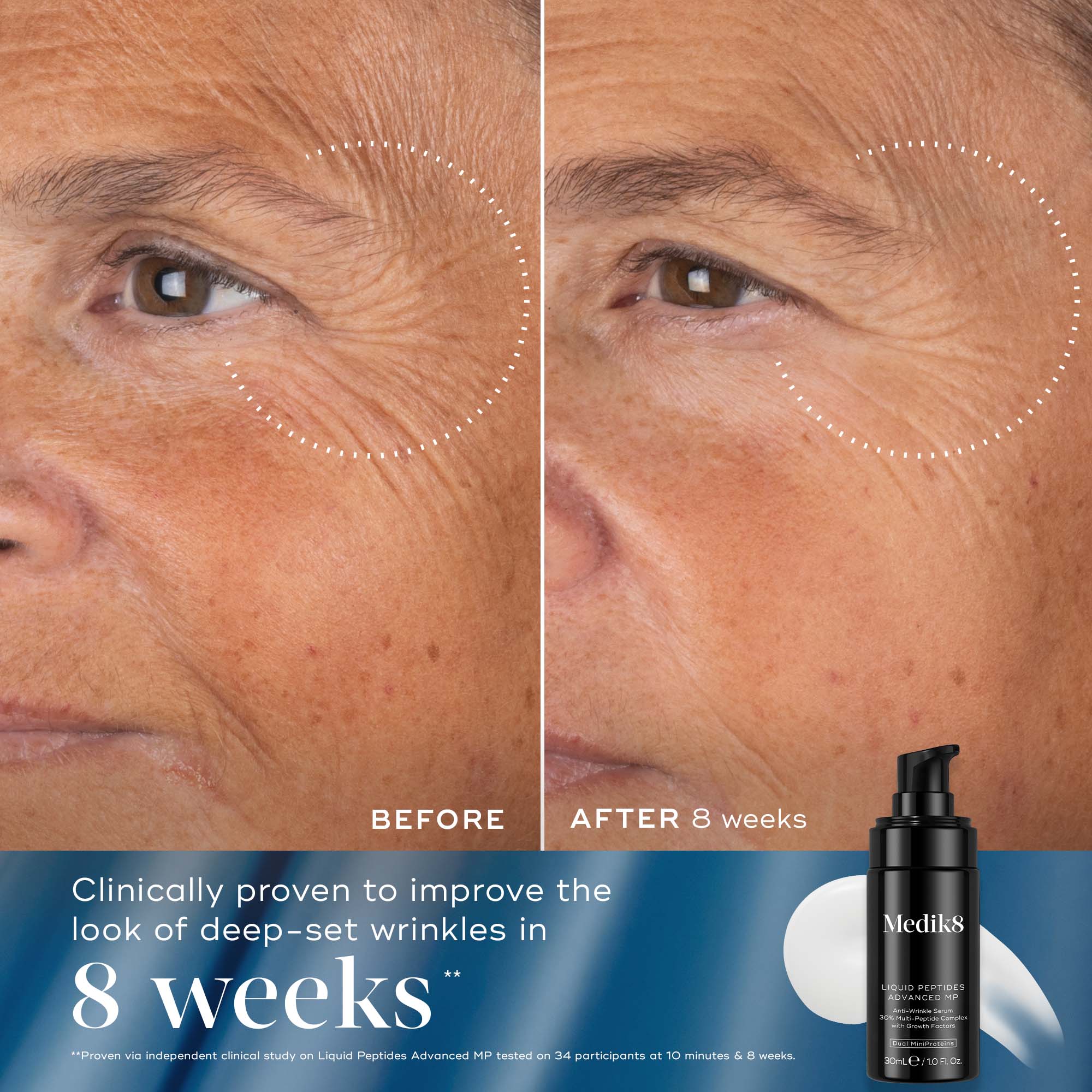 Medik8 Rejuvenation Reset 2025 Festive Pack - Image 6