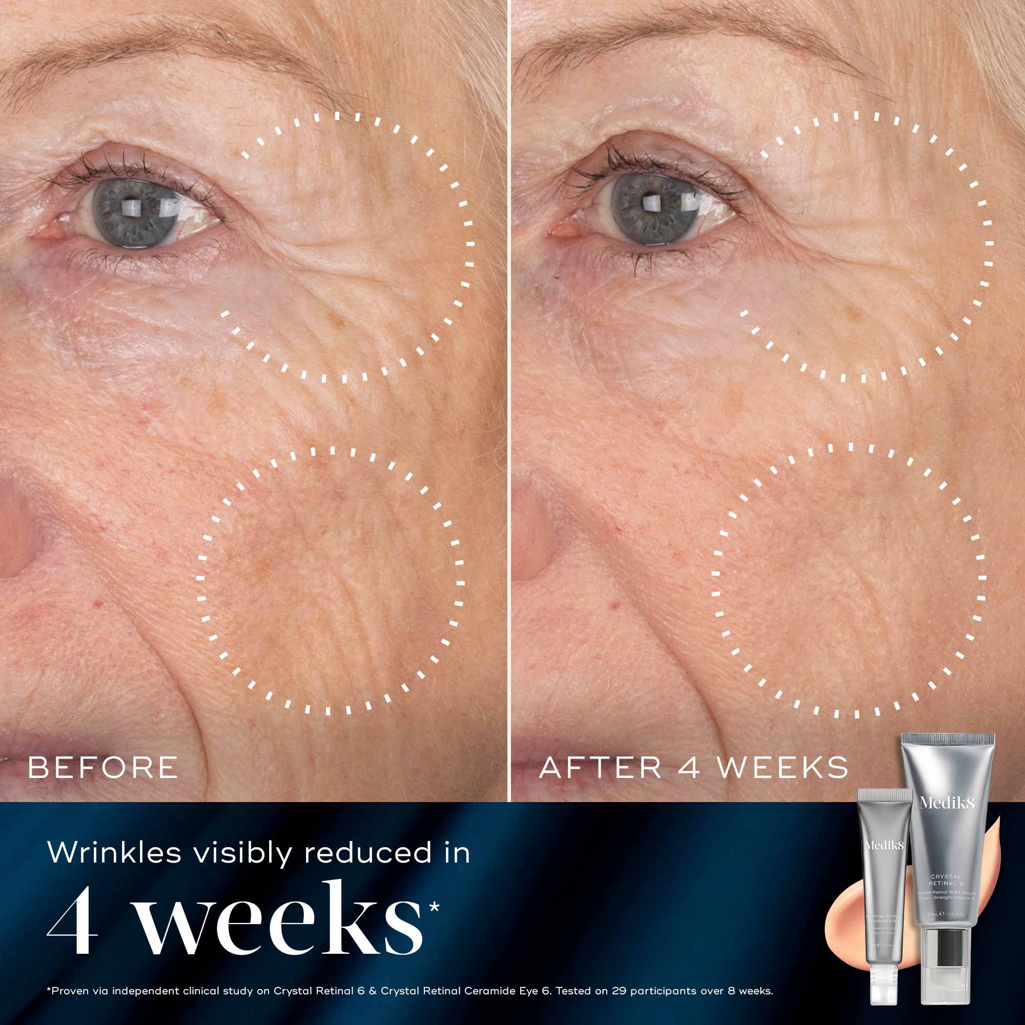 Medik8 Retinal Rewind 2025 Festive Pack - Image 5