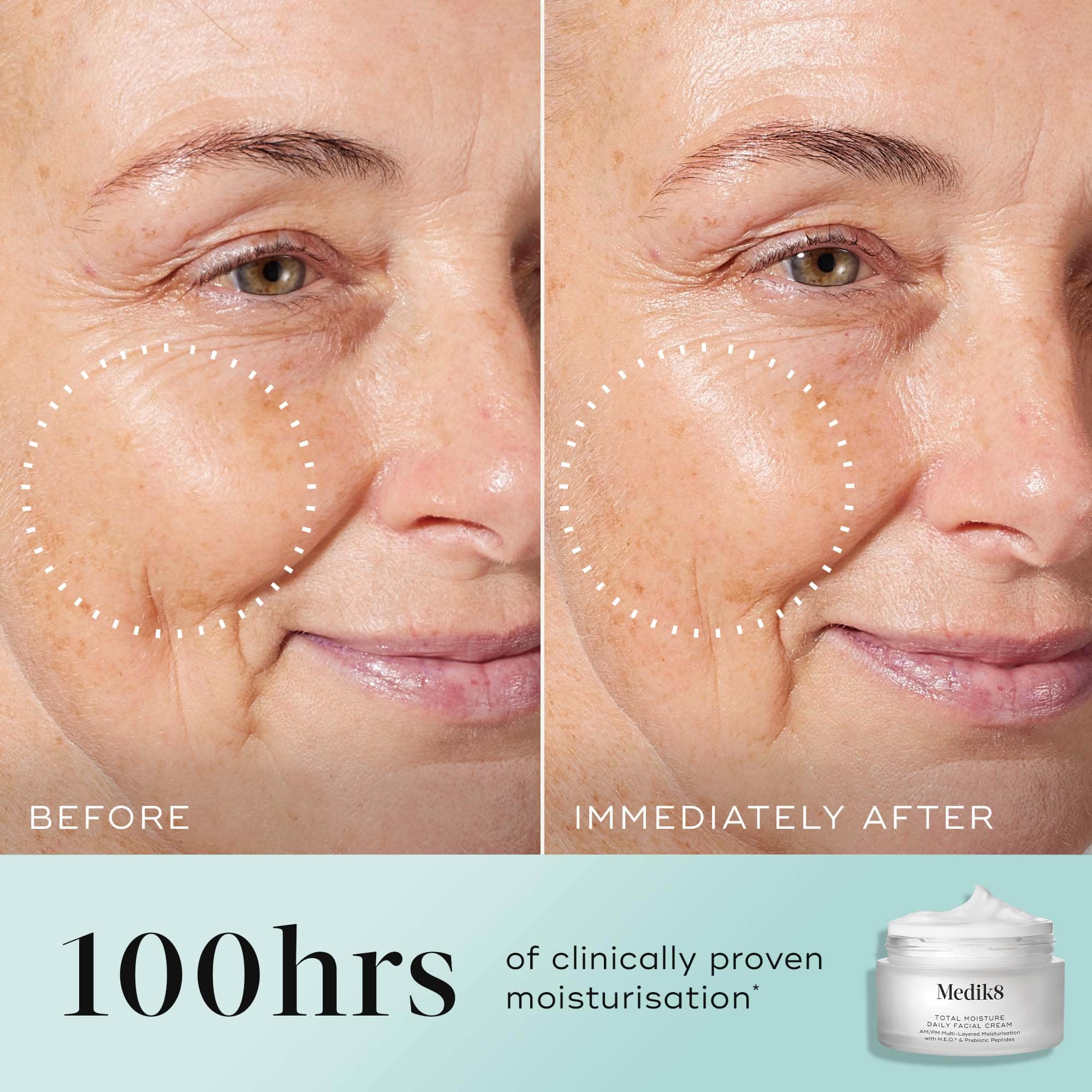 Total Moisture Daily Facial Cream 50ml - Image 3